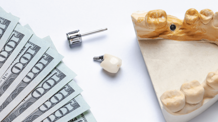 Dental Savings Plan vs Insurance: What's the Difference? - Bennie
